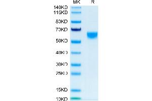 IL-9 Protein (AA 19-144) (Fc Tag)