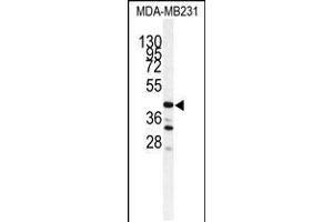 Western blot analysis of CTSS antibody in MDA-MB231 cell line lysates (35ug/lane) (Cathepsin S antibody  (AA 210-240))