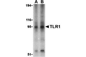 Western Blotting (WB) image for anti-Toll-Like Receptor 1 (TLR1) (Middle Region) antibody (ABIN1031127) (TLR1 antibody  (Middle Region))