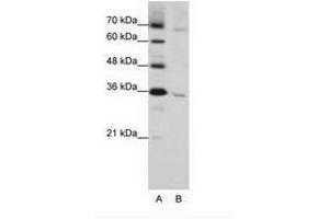 Image no. 1 for anti-Wingless-Type MMTV Integration Site Family, Member 5B (WNT5B) (C-Term) antibody (ABIN203075) (WNT5B antibody  (C-Term))