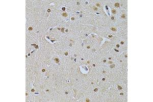 Immunohistochemistry of paraffin-embedded rat brain using ILK Antibody. (ILK antibody  (AA 1-260))