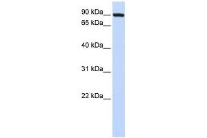 TFR2 antibody used at 1 ug/ml to detect target protein. (Transferrin Receptor 2 antibody  (N-Term))