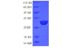 SDS-PAGE (SDS) image for CD24 Molecule (CD24) (AA 27-80) protein (GST tag) (ABIN1047637)