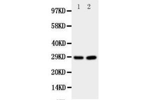 Western Blotting (WB) image for anti-Prion Protein (PRNP) (AA 143-159), (Middle Region) antibody (ABIN3044180)
