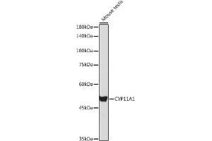 Western blot analysis of extracts of Mouse testis, using CYP11 antibody (6363) at 1:1000 dilution.