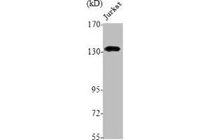 Western Blot analysis of Jurkat cells using NOS2 Polyclonal Antibody (NOS2 antibody  (C-Term))