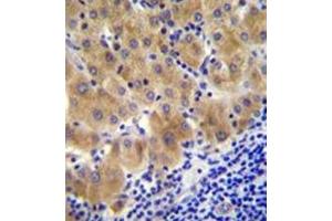 Formalin fixed and paraffin embedded human liver tissue reacted with GGH Antibody (C-term) followed by peroxidase conjugation of the secondary antibody and DAB staining. (GGH antibody  (C-Term))