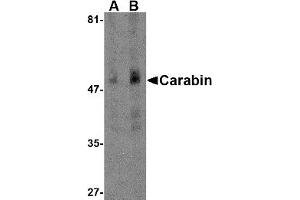 Western Blotting (WB) image for anti-TBC1 Domain Family, Member 10C (TBC1D10C) (N-Term) antibody (ABIN1031291) (Carabin antibody  (N-Term))