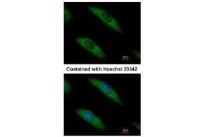 ICC/IF Image Immunofluorescence analysis of methanol-fixed HeLa, using Aldolase B, antibody at 1:500 dilution. (ALDOB antibody)