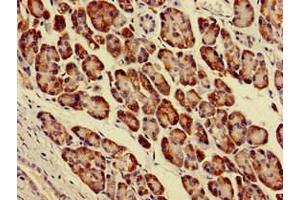Immunohistochemistry of paraffin-embedded human pancreatic tissue using ABIN7143927 at dilution of 1:100 (Parvin alpha antibody  (AA 2-94))