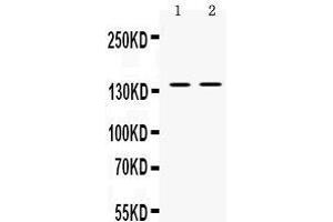 Western blot analysis of TRPM4 expression in mouse spleen extract (lane 1) and SW620 whole cell lysates (lane 2).