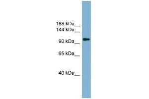 WB Suggested Anti-ACLY  Antibody Titration: 0. (ACLY antibody  (Middle Region))