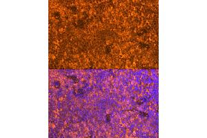 Immunofluorescence analysis of Mouse spleen using FB antibody (ABIN6129339, ABIN6140465, ABIN6140466 and ABIN6224941) at dilution of 1:100. (FAM65B antibody  (AA 1-210))