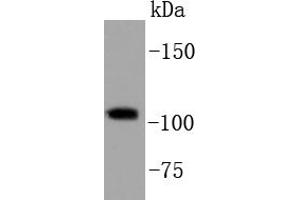 HeLa cell lysates, probed with PI3-kinase p110 subunit beta (34F12) Monoclonal Antibody  at 1:1000 overnight at 4˚C. (PIK3CB antibody)