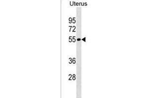 LRRIQ4 Antibody (N-term) (ABIN1538898 and ABIN2838169) western blot analysis in Uterus tissue lysates (35 μg/lane). (LRRIQ4 antibody  (N-Term))