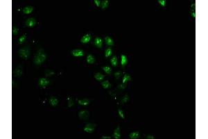 Immunofluorescence staining of Hela cells with ABIN7153753 at 1:100, counter-stained with DAPI. (SIP1 antibody  (AA 1-280))