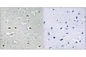 Immunohistochemistry analysis of paraffin-embedded human brain, using URB1 Antibody. (URB1 antibody  (AA 2013-2062))