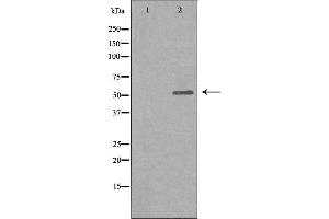 Western blot analysis of extracts from COLO205 cells, using GLR antibody.