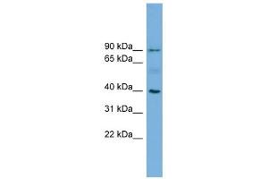 HFE antibody used at 1 ug/ml to detect target protein.