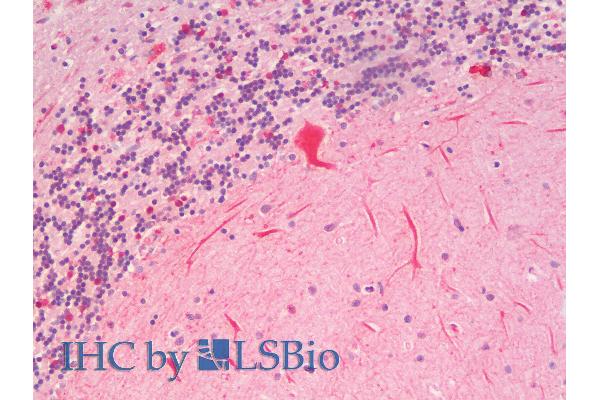 SLC7A6 antibody  (N-Term)