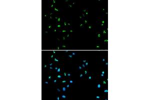 Immunofluorescence analysis of A549 cells using HDAC4 antibody (ABIN5970069). (HDAC4 antibody)