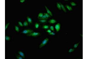 Immunofluorescent analysis of Hela cells using ABIN7174362 at dilution of 1:100 and Alexa Fluor 488-congugated AffiniPure Goat Anti-Rabbit IgG(H+L) (CYLD antibody  (C-Term))