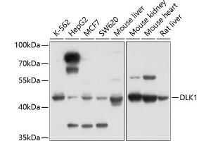 Western blot analysis of extracts of various cell lines, using DLK1 antibody (ABIN3016512, ABIN3016513, ABIN3016514 and ABIN6219768) at 1:1000 dilution. (DLK1 antibody)