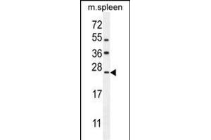 LMO4 Antibody (Center) (ABIN654714 and ABIN2844403) western blot analysis in mouse spleen tissue lysates (35 μg/lane). (LMO4 antibody  (AA 104-131))