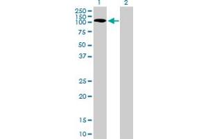 Western Blot analysis of PKN1 expression in transfected 293T cell line by PKN1 monoclonal antibody (M01), clone 1B10. (PKN1 antibody  (AA 462-615))
