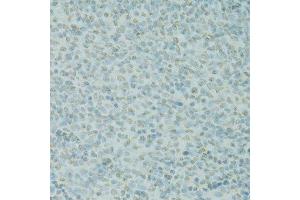 Immunohistochemistry of paraffin-embedded rat spleen using SAFB antibody.