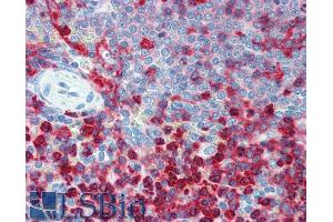 Immunohistochemistry staining of human spleen (paraffin sections) using anti-CD18 (Commercially tested by LifeSpan BioSciences.