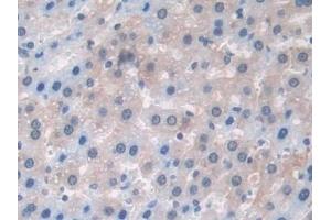 Detection of PDXK in Rat Liver Tissue using Polyclonal Antibody to Pyridoxal Kinase (PDXK)