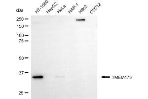 Western blotting analysis using TMEM173 antibody (ABIN7800620). (Recombinant STING/TMEM173 antibody)