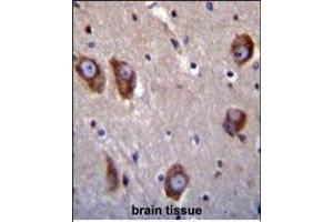 Immunohistochemistry (Paraffin-embedded Sections) (IHC (p)) image for anti-Brain-Specific Angiogenesis Inhibitor 1 (BAI1) (AA 1537-1567), (C-Term) antibody (ABIN392804)
