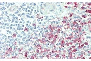 Detection of ICAM4 in Human Spleen Tissue using Polyclonal Antibody to Intercellular Adhesion Molecule 4 (ICAM4) (ICAM4 antibody  (AA 23-227))