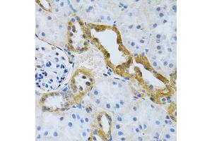 Immunohistochemistry of paraffin-embedded rat kidney using SLC4 antibody (ABIN6132890, ABIN6148015, ABIN6148016 and ABIN6214688) at dilution of 1:100 (40x lens).