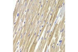 Immunohistochemistry of paraffin-embedded rat heart using GPD1 Antibody. (GPD1 antibody  (AA 1-349))