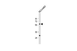 Anti-CARS2 Antibody (C-term) at 1:1000 dilution + NCI- whole cell lysate Lysates/proteins at 20 μg per lane. (CARS2 antibody  (C-Term))