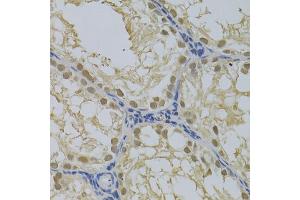 Immunohistochemistry of paraffin-embedded rat testis using DNMT3A Antibody (ABIN1872325) at dilution of 1:100 (40x lens). (DNMT3A antibody)