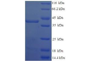 SDS-PAGE (SDS) image for TGFB-Induced Factor Homeobox 2-Like, X-Linked (TGIF2LX) (AA 1-241), (full length) protein (His-SUMO Tag) (ABIN5711499)