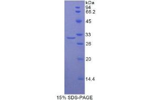 SDS-PAGE (SDS) image for Low Density Lipoprotein Receptor-Related Protein Associated Protein 1 (LRPAP1) (AA 90-342) protein (His tag) (ABIN2121552) (LRPAP1 Protein (AA 90-342) (His tag))