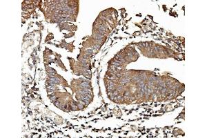 IHC analysis of TAB2 using anti-TAB2 antibody (ABIN7600244). (TAB2 antibody  (AA 169-522))