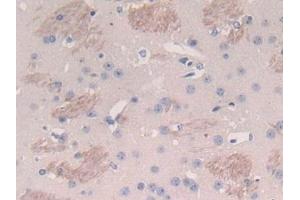 Detection of TP in Mouse Cerebrum Tissue using Polyclonal Antibody to Thymidine Phosphorylase (TP) (Thymidine Phosphorylase antibody  (AA 29-305))