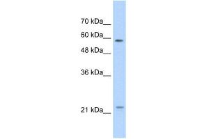 WB Suggested Anti-CAV1 Antibody Titration:  1. (Caveolin-1 antibody  (N-Term))