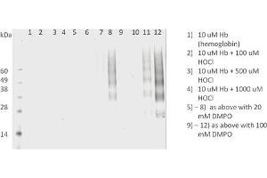 Western Blot analysis of Human HL 60 clone 15 eosinophils lysates showing detection of DMPO protein using Mouse Anti-DMPO Monoclonal Antibody, Clone N1664A (ABIN2482179).