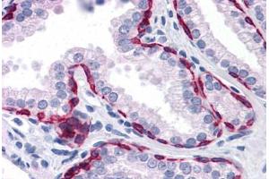 Human Prostate: Formalin-Fixed, Paraffin-Embedded (FFPE) (KRT81 antibody  (AA 1-203))