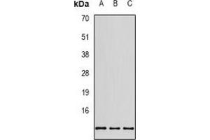 Western blot analysis of RPS20 expression in SHSY5Y (A), MCF7 (B), HEK293T (C) whole cell lysates. (RPS20 antibody)