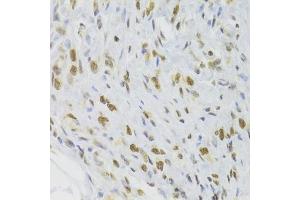 Immunohistochemistry (IHC) image for anti-Docking Protein 1, 62kDa (Downstream of tyrosine Kinase 1) (DOK1) (AA 1-280) antibody (ABIN6139763)