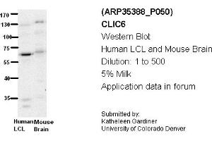 Image no. 2 for anti-Chloride Intracellular Channel 6 (CLIC6) (Middle Region) antibody (ABIN2776271) (CLIC6 antibody  (Middle Region))