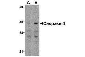 Western Blotting (WB) image for anti-Caspase 4, Apoptosis-Related Cysteine Peptidase (CASP4) (N-Term) antibody (ABIN1031297) (Caspase 4 antibody  (N-Term))
